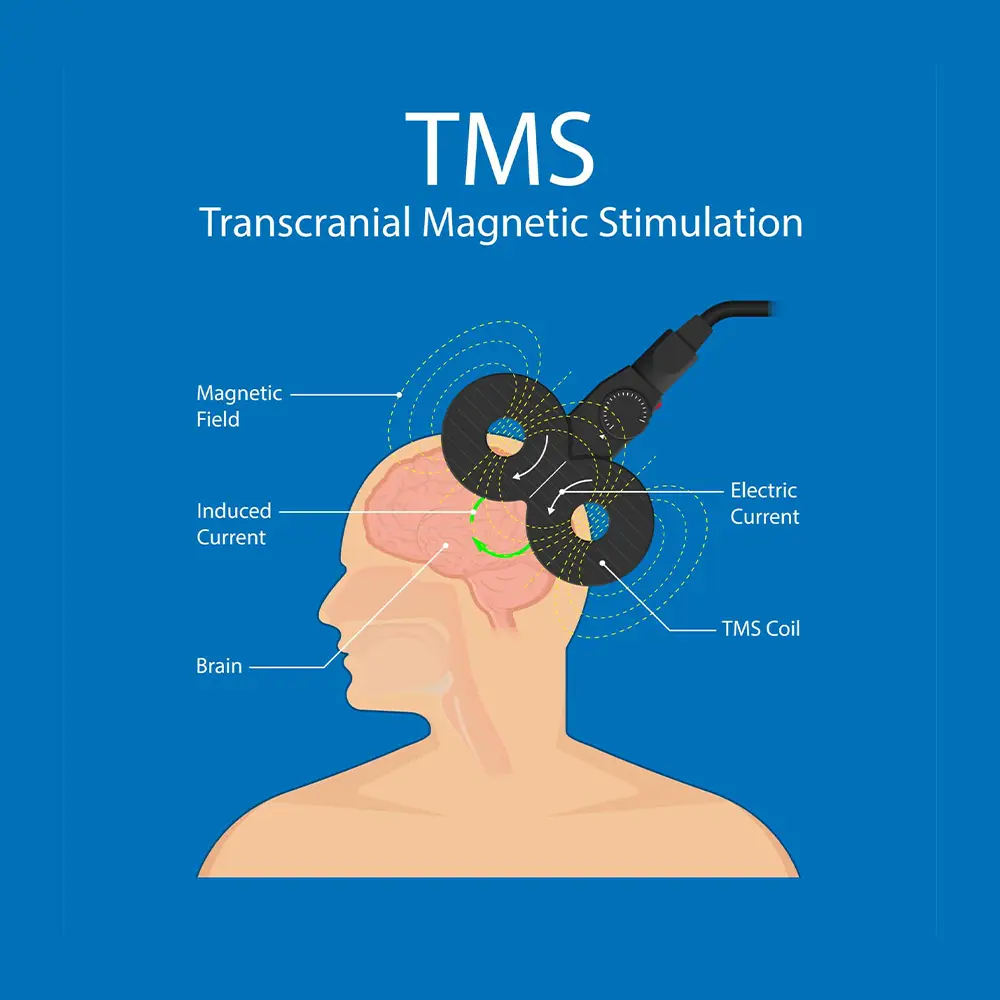 TMS Graph